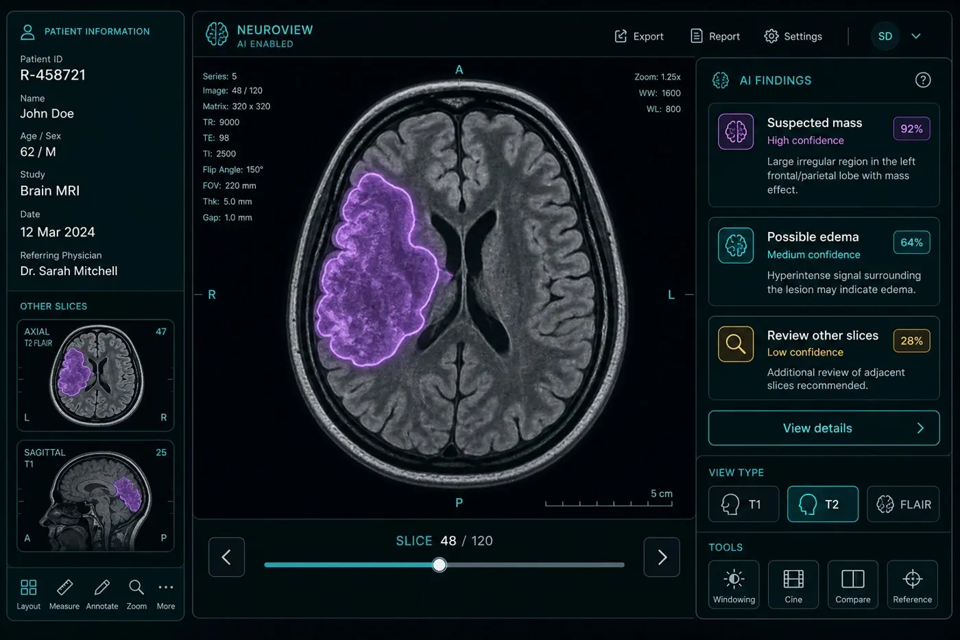 Radiology review workspace showing a brain MRI with AI-highlighted findings and a findings panel